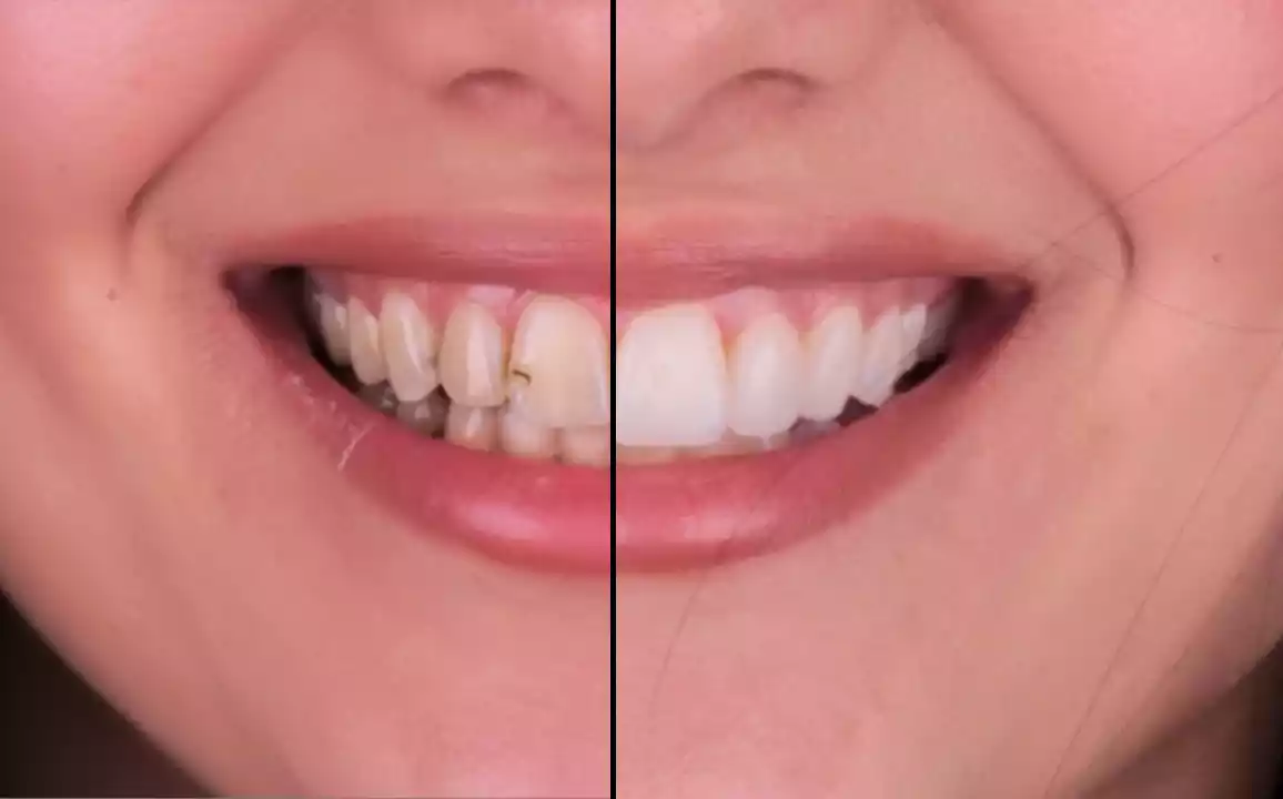 Rehabilitación Oral